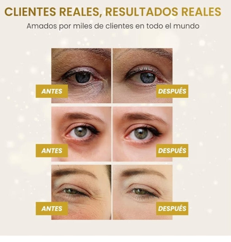 Parches de Oro 24K para Ojos – 60 Pcs ✨👁️